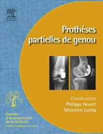 Proth?ses partielles du genou Proth?ses unicompartimentaires et f?moropatellaires【電子書籍】[ Philippe Neyret ]