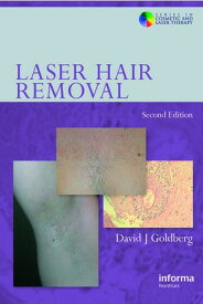 Laser Hair Removal【電子書籍】