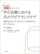がん治療における爪のアピアランスケア