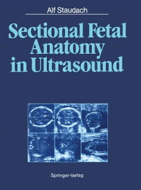 Sectional Fetal Anatomy in Ultrasound【電子書籍】[ Alf Staudach ]