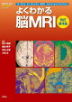 よくわかる脳MRI改訂第4版