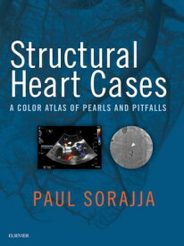 Structural Heart Cases E-Book A Color Atlas of Pearls and Pitfalls【電子書籍】[ John R Lesser, MD ]