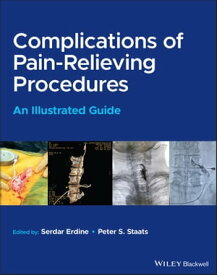 Complications of Pain-Relieving Procedures An Illustrated Guide【電子書籍】[ Serdar Erdine ]