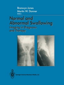Normal and Abnormal Swallowing Imaging in Diagnosis and Therapy【電子書籍】