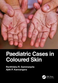 Paediatric Cases in Coloured Skin【電子書籍】[ Ranthilaka R. Gammanpila ]