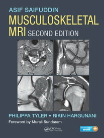 Musculoskeletal MRI【電子書籍】[ Asif Saifuddin ]