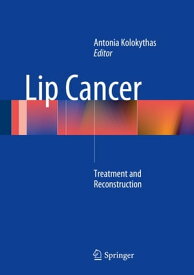 Lip Cancer Treatment and Reconstruction【電子書籍】