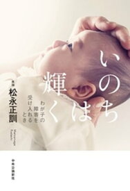 いのちは輝く　わが子の障害を受け入れるとき【電子書籍】[ 松永正訓 ]