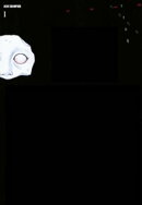不安の種フタの章（1）