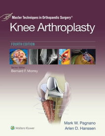Master Techniques in Orthopedic Surgery: Knee Arthroplasty【電子書籍】[ Mark W. Pagnano ]