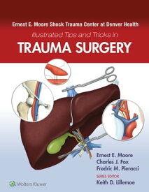 Ernest E. Moore Shock Trauma Center at Denver Health Illustrated Tips and Tricks in Trauma Surgery【電子書籍】[ Ernest E. Moore ]