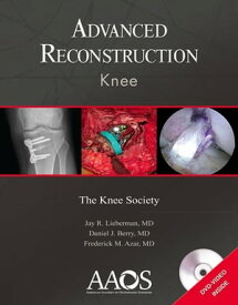 Advanced Reconstruction: Knee【電子書籍】[ Jay R. Lieberman, MD ]
