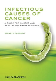 Infectious Causes of Cancer A Guide for Nurses and Healthcare Professionals【電子書籍】[ Kenneth Campbell ]