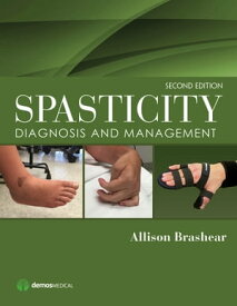 Spasticity Diagnosis and Management【電子書籍】