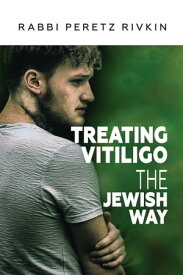Treating Vitiligo The Jewish Way【電子書籍】[ Peretz Rivkin ]