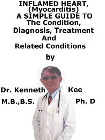 Inflamed Heart, (Myocarditis) A Simple Guide To The Condition, Diagnosis, Treatment And Related Conditions【電子書籍】[ Kenneth Kee ]