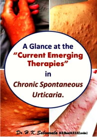 A Glance at the “Current Emerging Therapies” in Chronic Spontaneous Urticaria.【電子書籍】[ Dr. Hakim. K. Saboowala ]