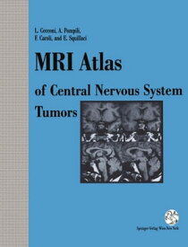 MRI Atlas of Central Nervous System Tumors【電子書籍】[ M. Crecco ]