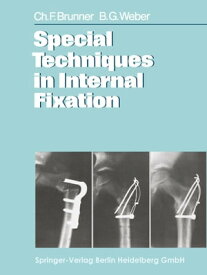 Special Techniques in Internal Fixation【電子書籍】[ C. F. Brunner ]