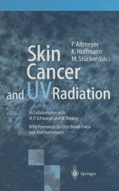 Skin Cancer and UV Radiation【電子書籍】[ M. Freitag ]