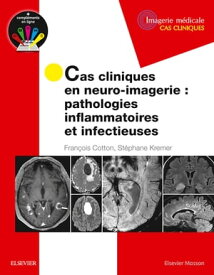 Cas cliniques en neuro-imagerie : pathologies inflammatoires et infectieuses【電子書籍】[ Fran?ois Cotton ]