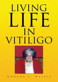 Living Life in Vitiligo【電子書籍】[ Norene L. Willis ]