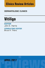 Vitiligo, An Issue of Dermatologic Clinics【電子書籍】[ John E. Harris, MD, PhD ]