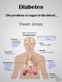 Diabetes The Problem Of Sugar In The Blood...【電子書籍】[ Owen Jones ]