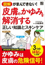 図解 がまんできない! 皮膚のかゆみを解消する正しい知識とスキンケア【電子書籍】[ 小林美咲 ]