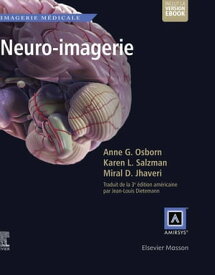 Neuro-imagerie【電子書籍】[ Karen L. Salzman, MD ]