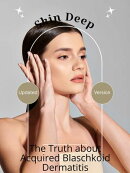 Skin Deep