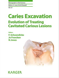 Caries Excavation: Evolution of Treating Cavitated Carious Lesions【電子書籍】
