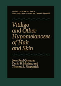 Vitiligo and Other Hypomelanoses of Hair and Skin【電子書籍】[ Jean-Paul Ortonne ]