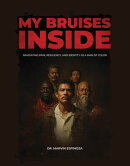 My Bruises Inside