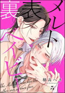 裏表メルトベイビー（分冊版） 【第3話】