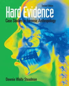 Hard Evidence Case Studies in Forensic Anthropology【電子書籍】