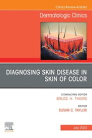 Diagnosing Skin Disease in Skin of Color, An Issue of Dermatologic Clinics, E-Book【電子書籍】