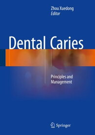 Dental Caries Principles and Management【電子書籍】