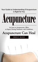 Acupuncture: Your Guide to Understanding if Acupuncture is Right for You (An Intro to Acupuncture, What to Expect During Treatment, and Conditions Acupuncture Can Heal)