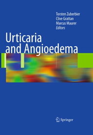 Urticaria and Angioedema【電子書籍】