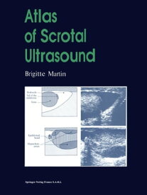 Atlas of Scrotal Ultrasound【電子書籍】[ Brigitte Martin ]