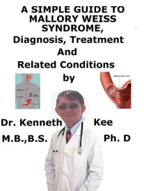 A Simple Guide to Mallory Weiss Syndrome, Diagnosis, Treatment and Related Conditions【電子書籍】[ Kenneth Kee ]