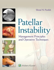 Patellar Instability Management Principles and Operative Techniques【電子書籍】[ Shital N. Parikh ]