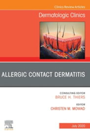 Allergic Contact Dermatitis,An Issue of Dermatologic Clinics - E-Book Allergic Contact Dermatitis,An Issue of Dermatologic Clinics - E-Book【電子書籍】[ Christen M. Mowad ]