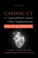 Cardiac CT for TAVI