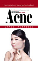 Acne: Everything You Need to Know to Cure Your Acne Quickly (The Ultimate Acne Treatment, Diet & Remedies Guide for Overcoming Acne Forever)