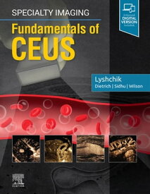 Specialty Imaging: Fundamentals of CEUS E-Book Specialty Imaging: Fundamentals of CEUS E-Book【電子書籍】[ Andrej Lyshchik, MD, PhD ]