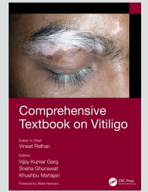 Comprehensive Textbook on Vitiligo【電子書籍】