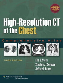 High-Resolution CT of the Chest Comprehensive Atlas【電子書籍】[ Eric J. Stern ]