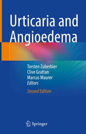 Urticaria and Angioedema【電子書籍】